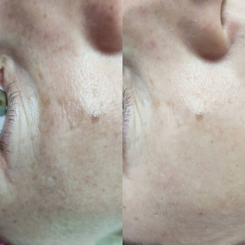 Катерина Вечорко, Ровно Фото - 10