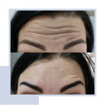 Катерина Вечорко, Ровно Фото - 11