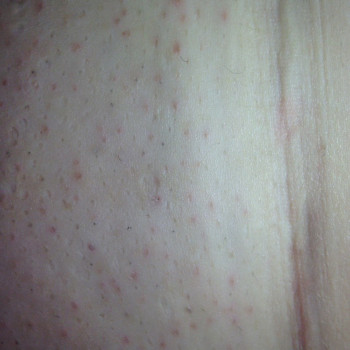 Лена Смирных, Харьков Фото - 6