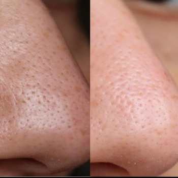 Лана Кошовенко, Київ Фото - 10