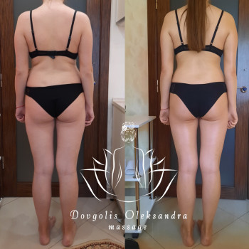 10 сеансів До Після