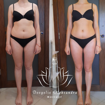 10 сеансів До Після