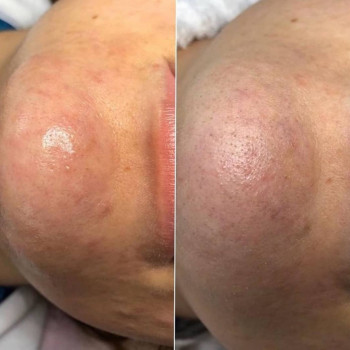 Любов Кричун, Київ Фото - 13