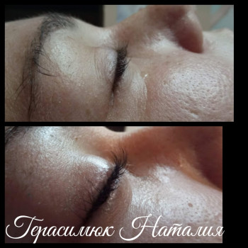 ламинирование ресниц