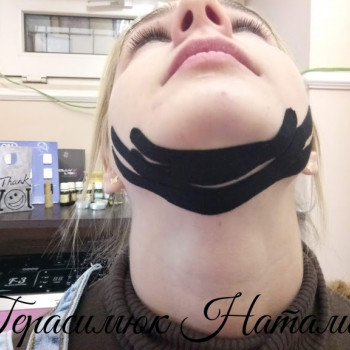 кинезиотейпирование