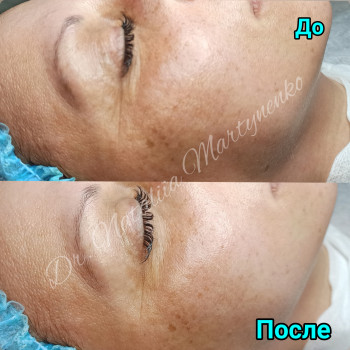 Наталия Мартыненко, Сумы Фото - 53