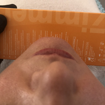 Контурна пластика обличчя