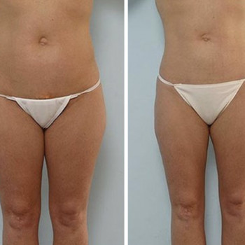 Маргарита Свердлова, Київ Фото - 4