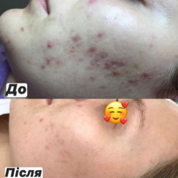 Deja Vu, Ковель Фото - 5