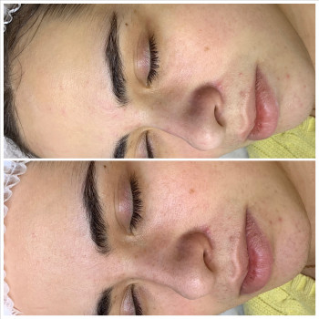 Олена Смульська, Хмельницький Фото - 23