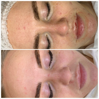 Олена Смульська, Хмельницький Фото - 29