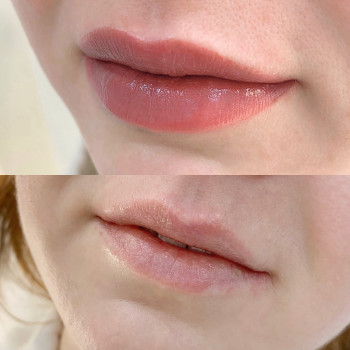 Алёна Степура, Киев Фото - 6