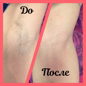 Ольга Жужуленко, Одесса Фото - 3