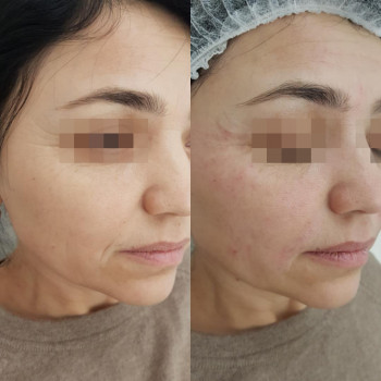 Grace Clinic, Київ Фото - 13