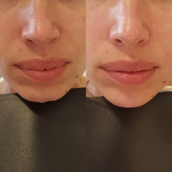 Grace Clinic, Київ Фото - 18