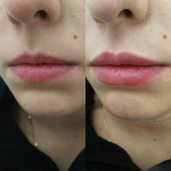 Grace Clinic, Київ Фото - 24