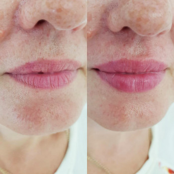 Grace Clinic, Київ Фото - 27