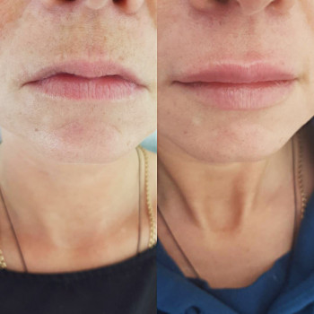 Grace Clinic, Київ Фото - 30