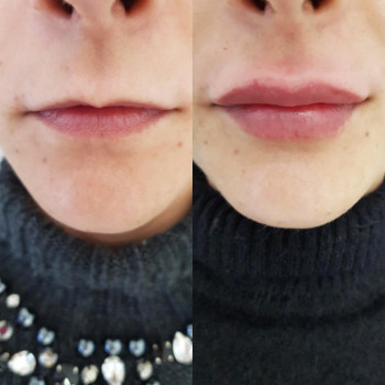 Grace Clinic, Київ Фото - 32