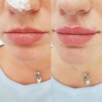 Grace Clinic, Київ Фото - 33