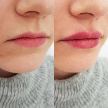 Grace Clinic, Київ Фото - 35