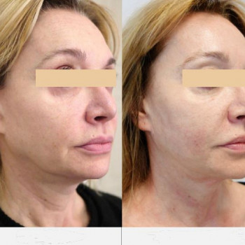 Grace Clinic, Київ Фото - 36