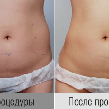 Grace Clinic, Київ Фото - 41