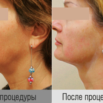 Grace Clinic, Київ Фото - 43