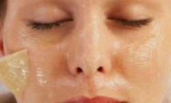 Пілінг radiance PEEL Косметологічний центр N.A.M. esthetic Київ