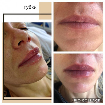 Тетяна Магерко, Калуш Фото - 5