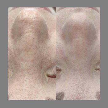 Ольга Жужуленко, Одесса Фото - 9