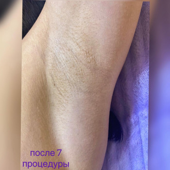 Epilas, Дніпро Фото - 12