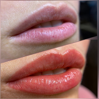 Юлия Старовойт, Бровары Фото - 8