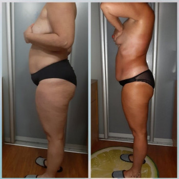 После курса 10 сеансов