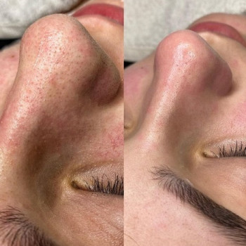 Bliss, Коломыя Фото - 7