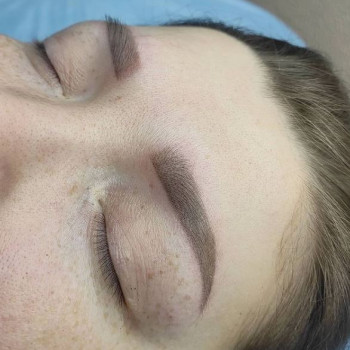 Пудрове напилення, заживший результат