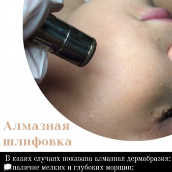 Tina Ricca, Кривой Рог Фото - 6