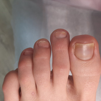 Аппаратный педикюр