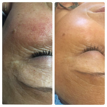 Вікторія Панченко, Черновцы Фото - 5