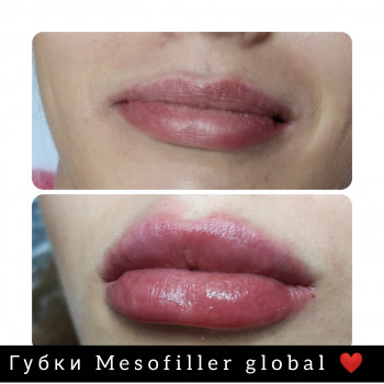 Наталя Астахова, Кривий Ріг Фото - 6