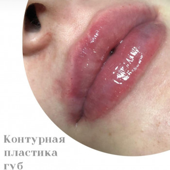 Tina Ricca, Кривой Рог Фото - 1