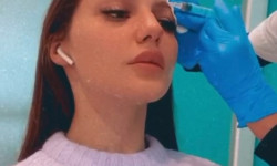 Мезотерпия волосся Косметологічний центр N.A.M. esthetic Київ