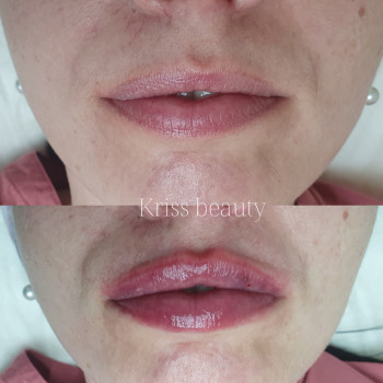 Христина Магдич, Тернопіль Фото - 5