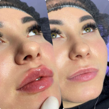 0,7 препарата