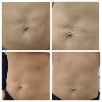 работа со стриями