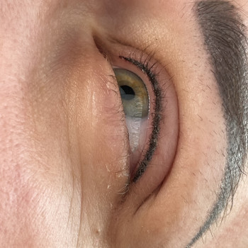 ПМ межресничка