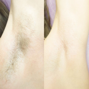 Инна Калинчук, Запорожье Фото - 6