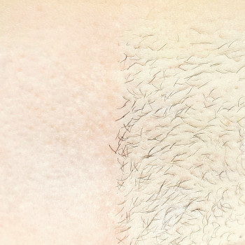 Инна Калинчук, Запорожье Фото - 7