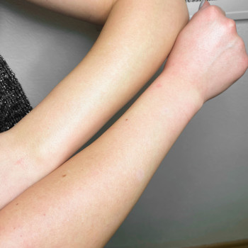 Инна Калинчук, Запорожье Фото - 8