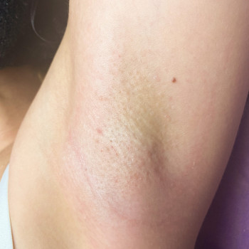 Инна Калинчук, Запорожье Фото - 10